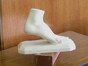 石膏の足